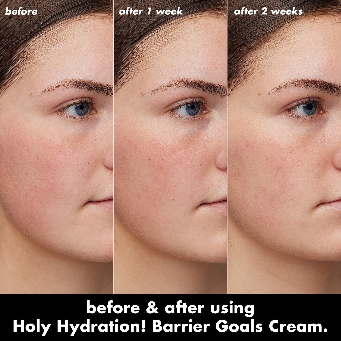 holy-hydration-barrier-goals-cream-mini-a2 0226_EDU_HHBarrierGoalsCream_B_A_Zoe_TRYPTICH_4f0e5b5d-35fb-4020-968e-244d4536afbd.jpg