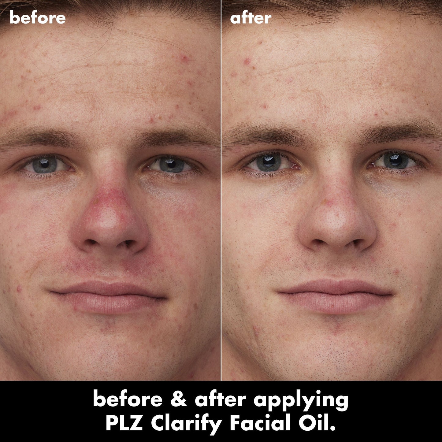 plz-clarify-facial-oil-s9 0326_EDU_PlzClarify_BA_Caleb.jpg