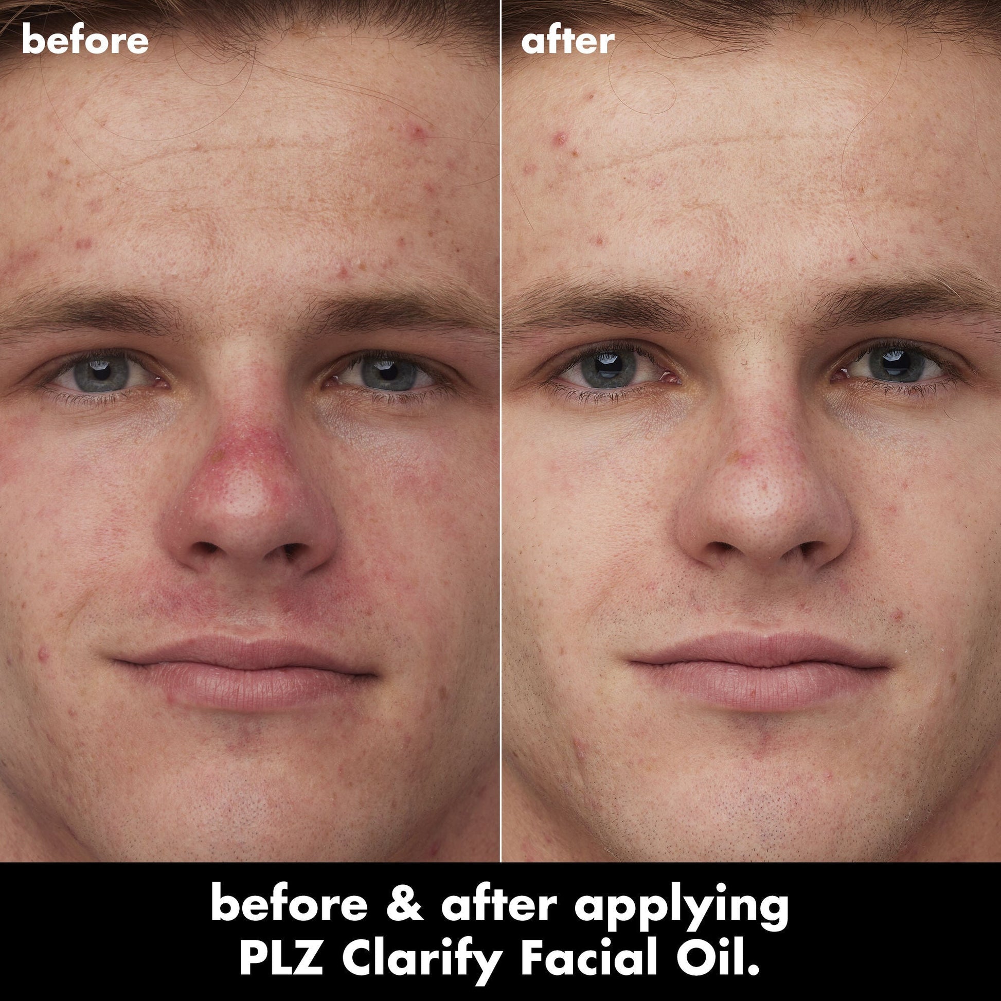 plz-clarify-facial-oil-s9 0326_EDU_PlzClarify_BA_Caleb.jpg