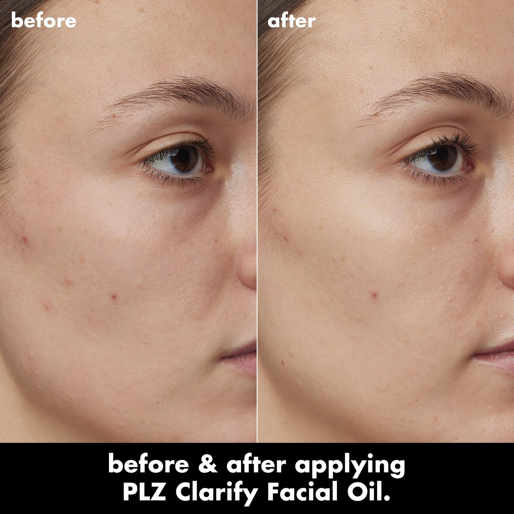 plz-clarify-facial-oil-s9 0326_EDU_PlzClarify_BA_Kelly.jpg