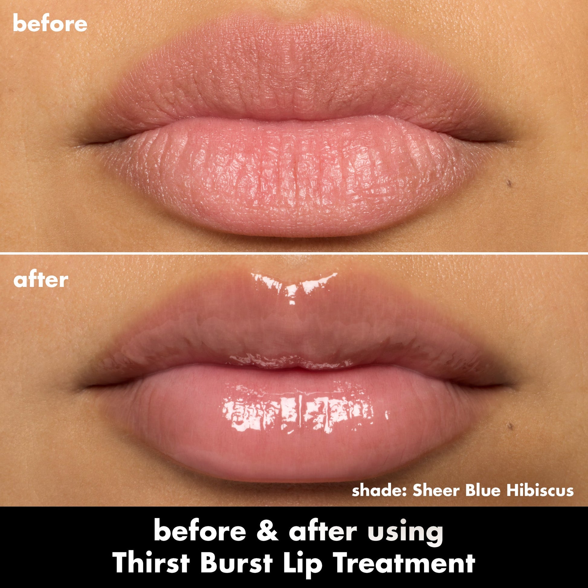 Before and after comparison of lips using Thirst Burst Lip Treatment with shade Sheer Blue Hibiscus