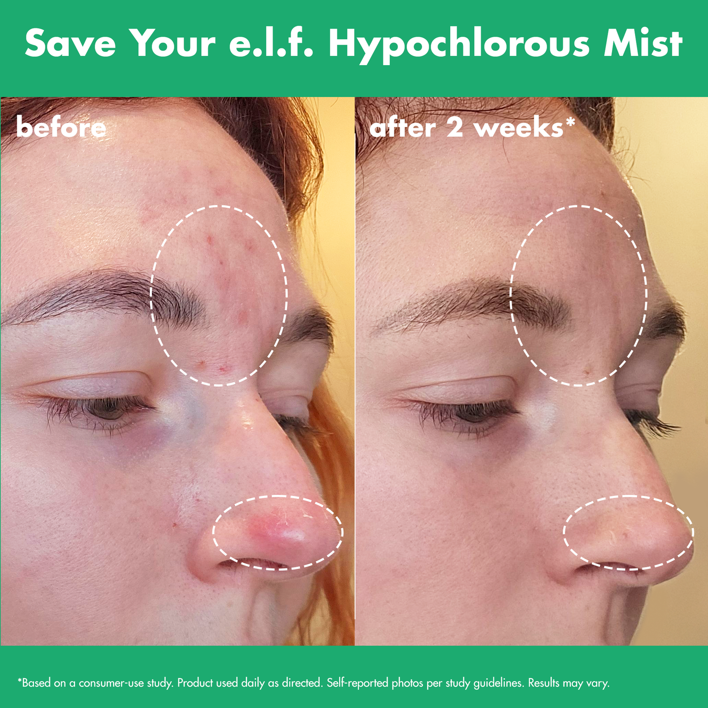 save-your-e-l-f-hypochlorous-mist-o0 FA26_EDUCATION_SAVEYOURELF_USAGE_BA1_WITHOUT_CLAIMS.png